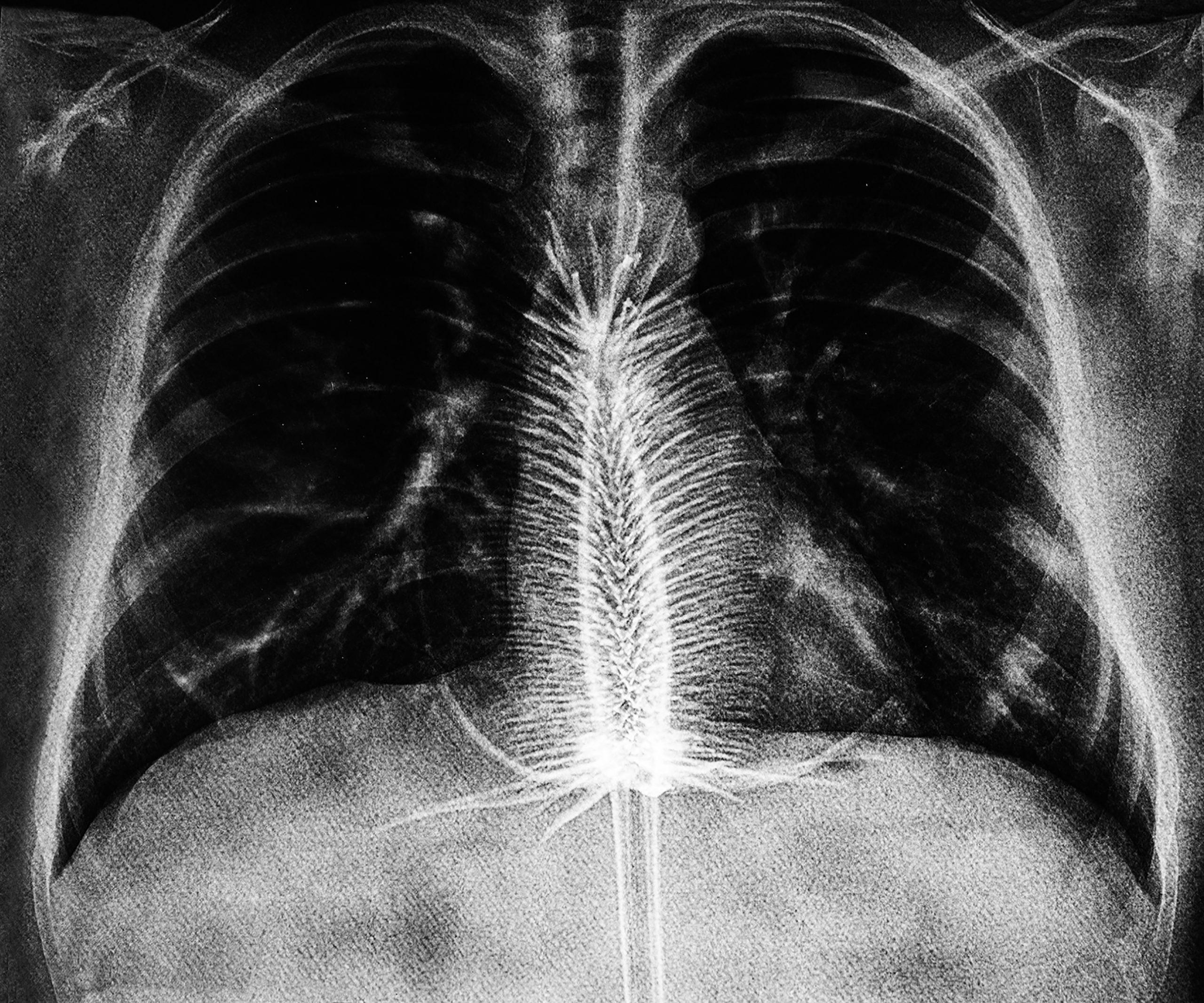 85c4bf4a17518ae7c18aac91b705bdac 4ad